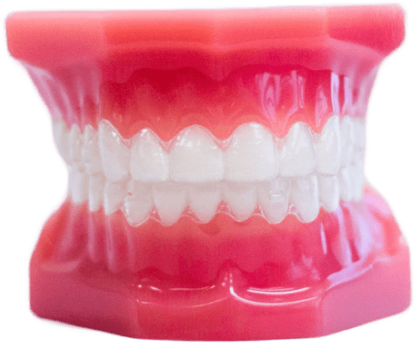 Invisalign Invisalign
